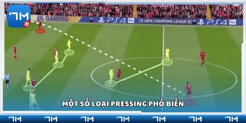 Các loại pressing phổ biến